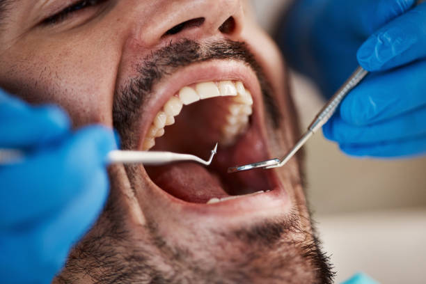 Emergency Dental Services in Rio Del Mar, CA